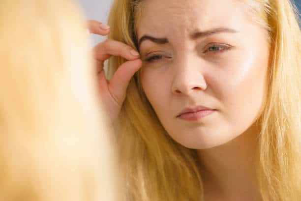 What to Do if There’s a Pimple on Your Eyelid